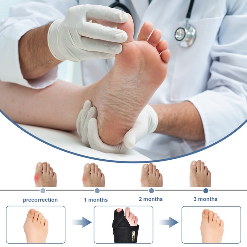 Bunion Corrector and Toe Straightener & Adjustable Orthopedic Pneumatic Bunion