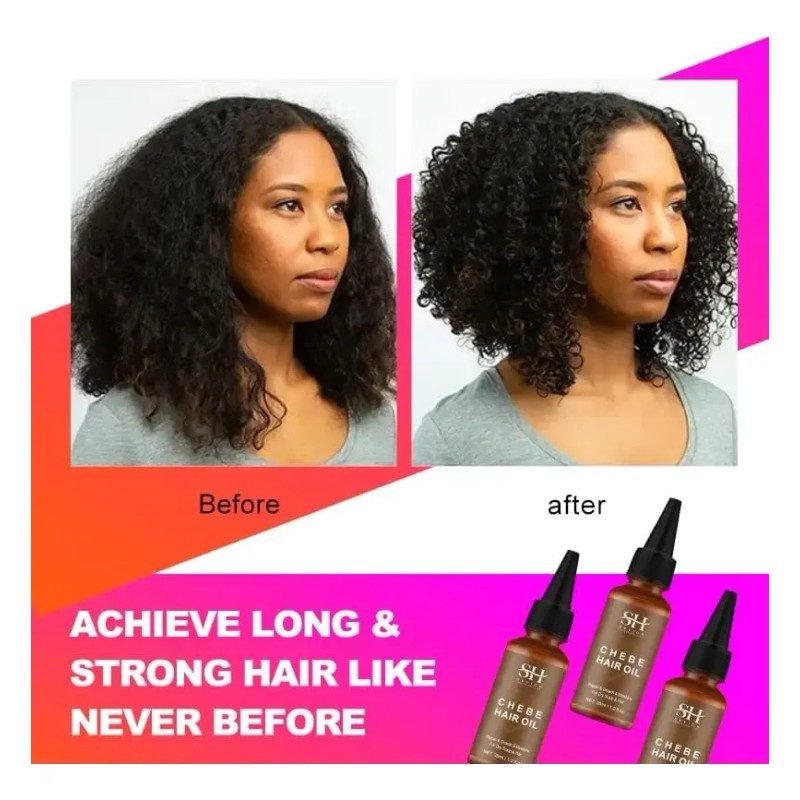 Hair Oil Sevich Chebe Powder Serum 30ml Hair Loss Treatment