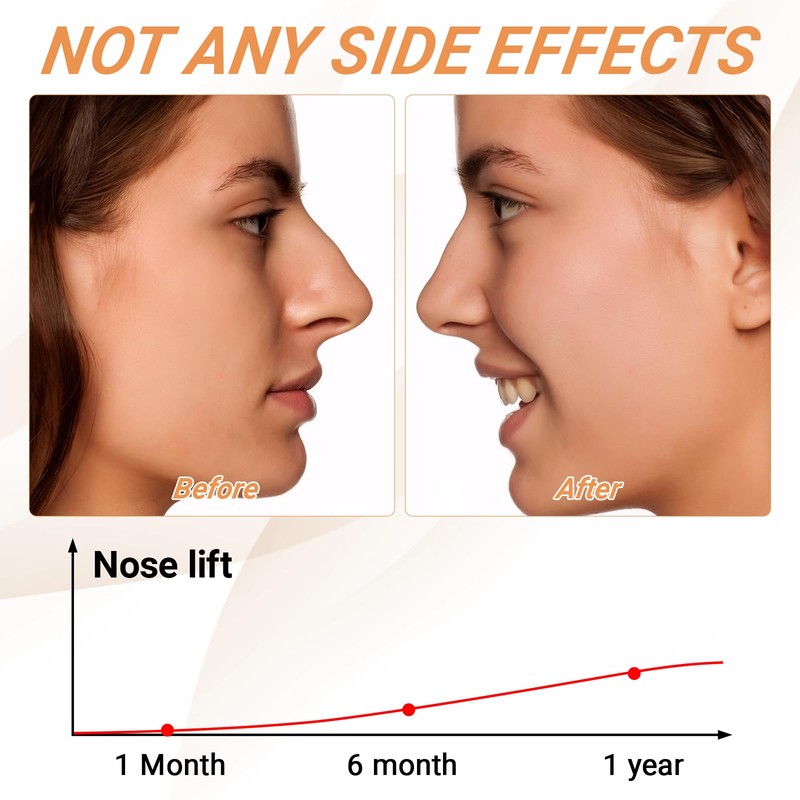5 Pcs Nose Lifter - Nose Shaper Clip ＆ Instant