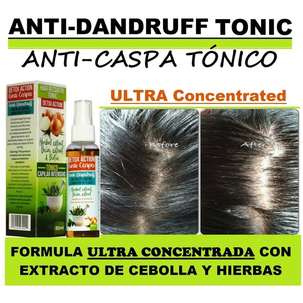 2oz Anti-Dandruff Tonic, Tonico anti-caspa