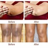 New Strong Whitening Cream For Removing Dark Knuckle Finger Elbow