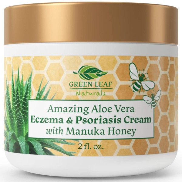 Manuka Honey Eczema Cream (2oz) Moisturizing Lotion Treatment For Psoriasis Relief - Itchy, Dry Skin Rash Healing Ointment - Skin Soothing Moisturizer For Kids, Adults, Baby Ultra Strength Honey Creme For Eczema