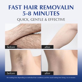 EXPRESSIONS WELLNESS Hair Removal Cream for Sensitive Body, Women and Men