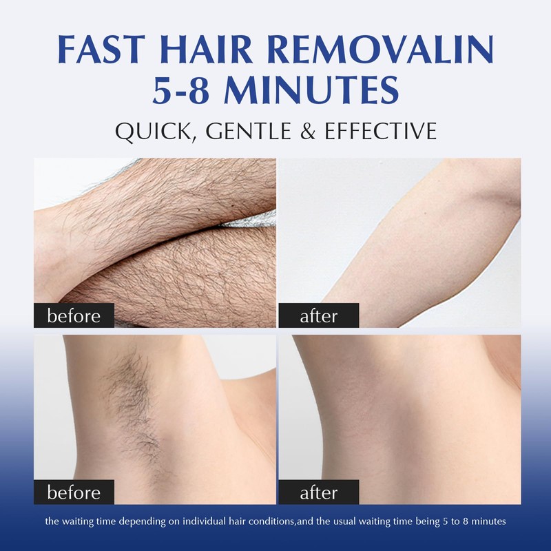 EXPRESSIONS WELLNESS Hair Removal Cream for Sensitive Body, Women and