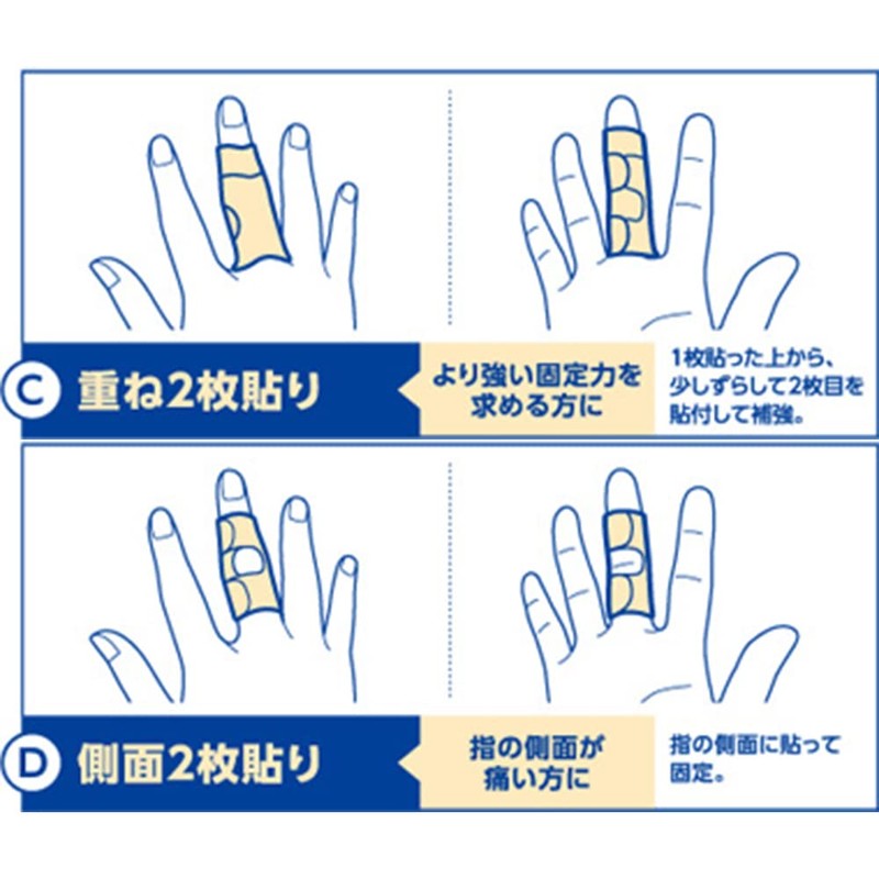 Nichiban YP10SM Battlewin Finger Protector, Small to Medium