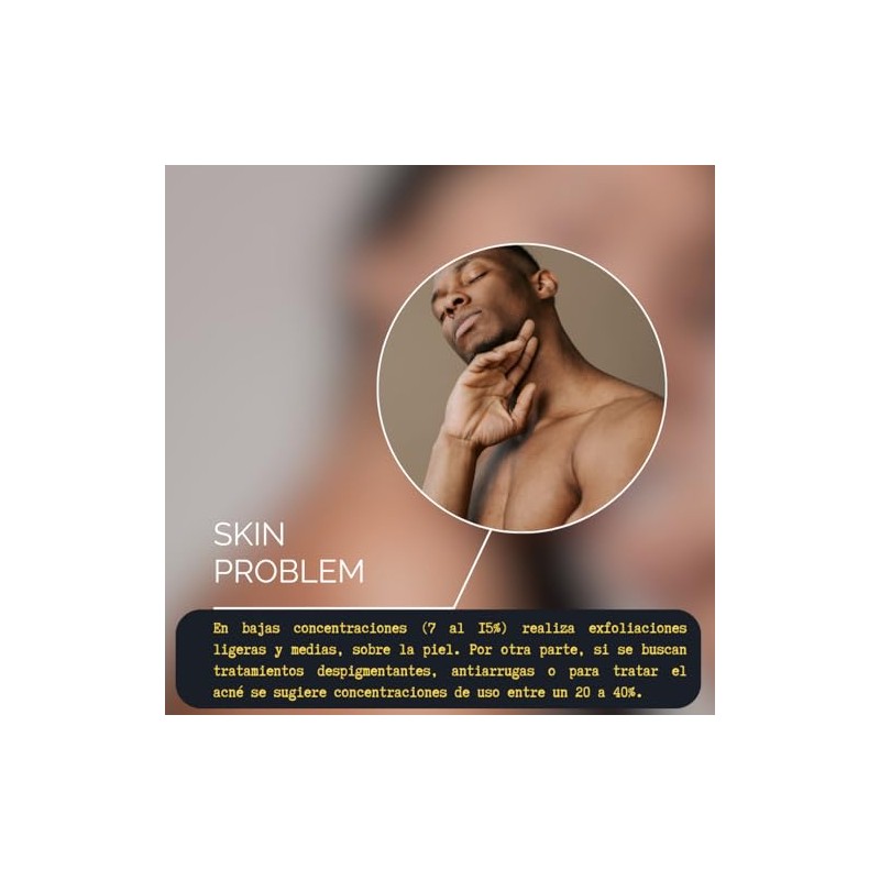 50 ml Ácido Glicólico Solución Peeling – AHA AL (15%)