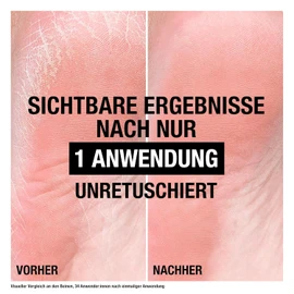 Neutrogena Norwegian Formula Foot Care Cream for Cracked Heels, 50 ml