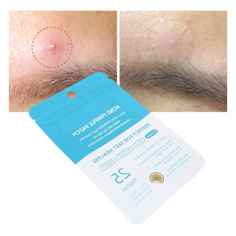 25 Parches Para Eliminar Cicatrices, Acné, Acné, Acné, Ma