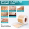 Pumkot Silicone Scar Tape Roll 1.6"x120" Surgical Scars Keloid Burn