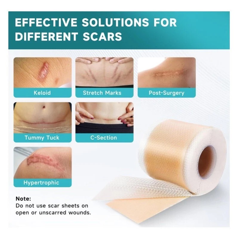 Pumkot Silicone Scar Tape Roll 1.6"x120" Surgical Scars Keloid Burn