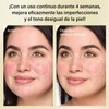 Crema con Ácido Azelaico al 10%, 50g