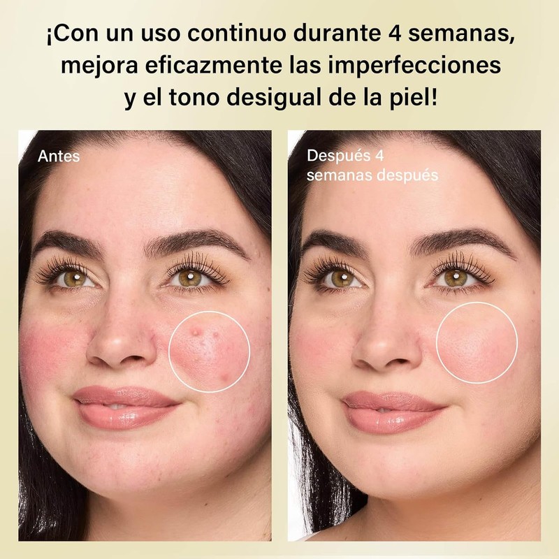 Crema con Ácido Azelaico al 10%, 50g