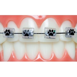Snapcaps Braces Bumper Cover, Orthodontic Bracket Wax Substitute, Alternative Snap-on Braces Guard Braces Accessories 10 pack (Paw Print)