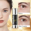 Unbranded Harvey Ross Lift Eye Cream For Puffiness and Fine
