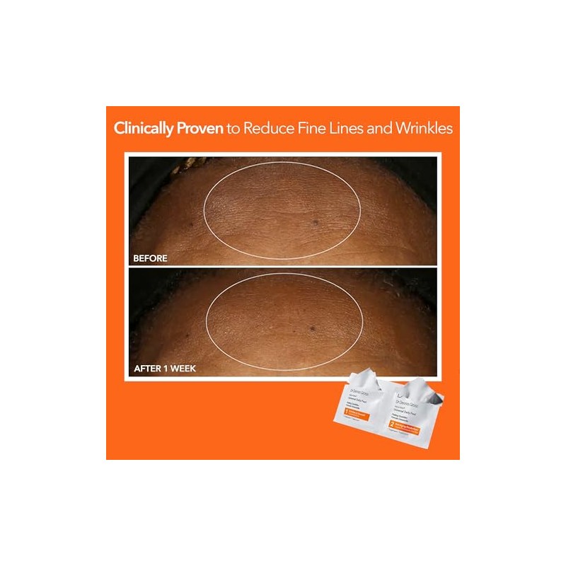Dr. Dennis Gross Skincare Alpha Beta Peel Original Formula Packets,