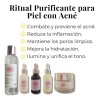 Kit Purificante Acné Lilo Skincare Niacinamida Y Retinol