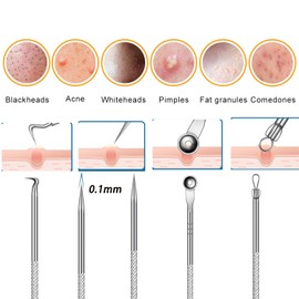 Fecong Tweezers, Fecong Stainless Steel Blackhead Removal Kit, Acssart Tweezers, Blackhead Extractor, Pore Cleaner Tool, Gentle and Easy to Clean (8PCS Silver)