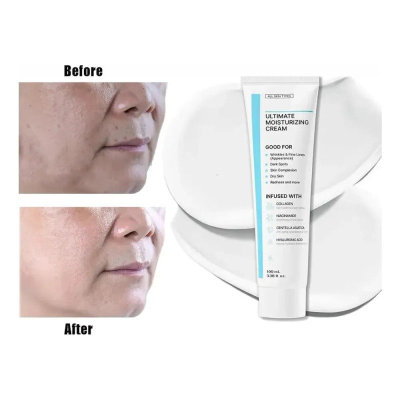 Crema Hidratante Definitiva De Frmula Juvenil, Crema