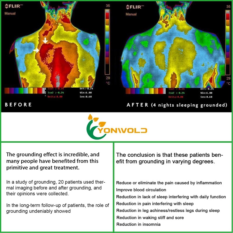 Yonwold Organic Grounding Sheet 10% Silver for Bed Sleeping Therapy