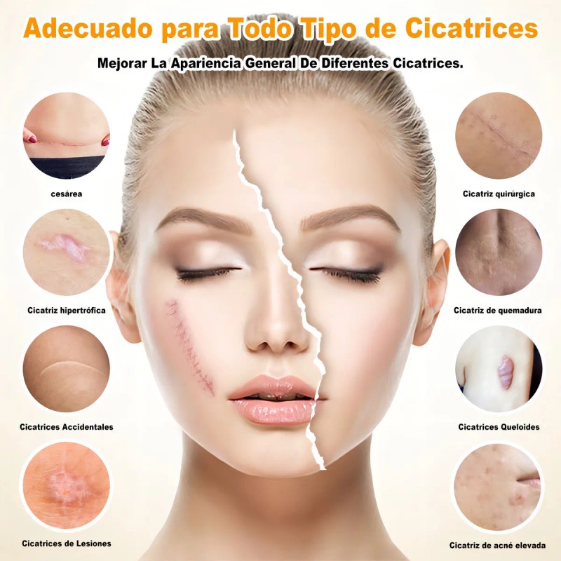 Crema Eliminar Cicatrices Gel Depara Reparar