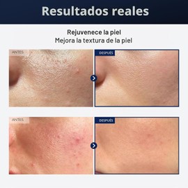 TOSOWOONG Black Snail Plus Essence con filtro de secreción de caracol negro de 960,890 ppm, suero hidratante, reparador, antienvejecimiento, piel opaca, líneas finas, piel sensible, cuidado de la piel