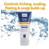 Shampoo Terapéutico Psoriasis Mg217 240ml Alquitrán Carbon