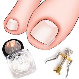 2 Piece Set Ingrown Toenail Correction Strips Brace Kit Ingrown Toenail Treatment Strips Toe Nail Pedicure Clamp Care Tool for Women Men Foot Care Paronychia