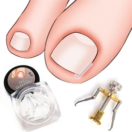 2 Piece Set Ingrown Toenail Correction Strips Brace Kit Ingrown Toenail Treatment Strips Toe Nail Pedicure Clamp Care Tool for Women Men Foot Care Paronychia