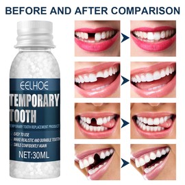 OYZOQ Provisorischer Zahnersatz, Zahn reparatur set Zahnfüllung Selber Machen, Zur Reparatur Abgebrochener Zähne, 30ML