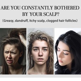 XURJUMI Dandruff Comb, 2 Piezas Lice Comb, Hollow Tooth Head, Energy Massage, Hair Comb with Handle, Hair Comb for Dandruff, Better Hair Quality, Scalp Comb for Women and Men Removal