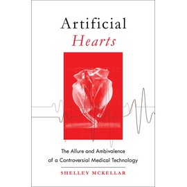Artificial Hearts: The Allure and Ambivalence of a Controversial Medical Technology
