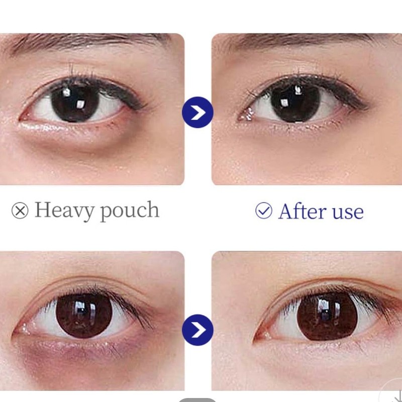LGLAU Anti-Wrinkle Power Firming Eye Cream Reduce Crow's Feet,Lines,Wrinkles, Powerful