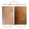Pomada Tepezcohuite Árbol De Vida Crema Natural Piel 120gr