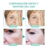 Ab La Crema Correctora De Manchas Aclara Las Manchas Oscuras