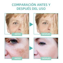 Ab La Crema Correctora De Manchas Aclara Las Manchas Oscuras