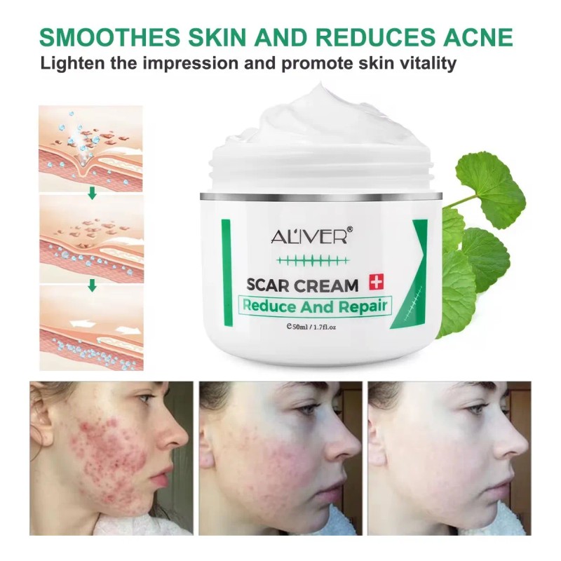 Crema Reduce Cicatriz Queloide Promueve Regeneracion Celular Neutral