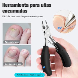 BTOOTB 7 Pcs Kit De Herramientas Cortauñas, Acero Inoxidable Uñas Encarnadas Cortauñas Alicates, kit de pedicura para pies, Cortaúñas grueso para personas mayores, kit podologia profesional, pedicure kit