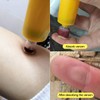 Snake Bite Kit, Bee Sting Kit, Emergency First Aid Supplies,