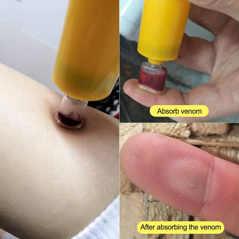 Snake Bite Kit, Bee Sting Kit, Emergency First Aid Supplies,
