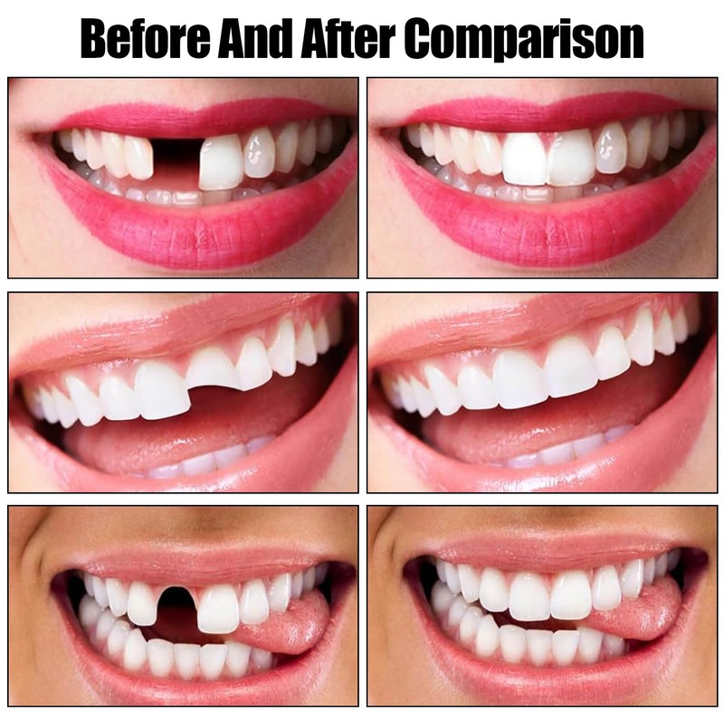 Pack of 56 Multi-Purpose False Teeth, Synthetic Polymer Teeth, False