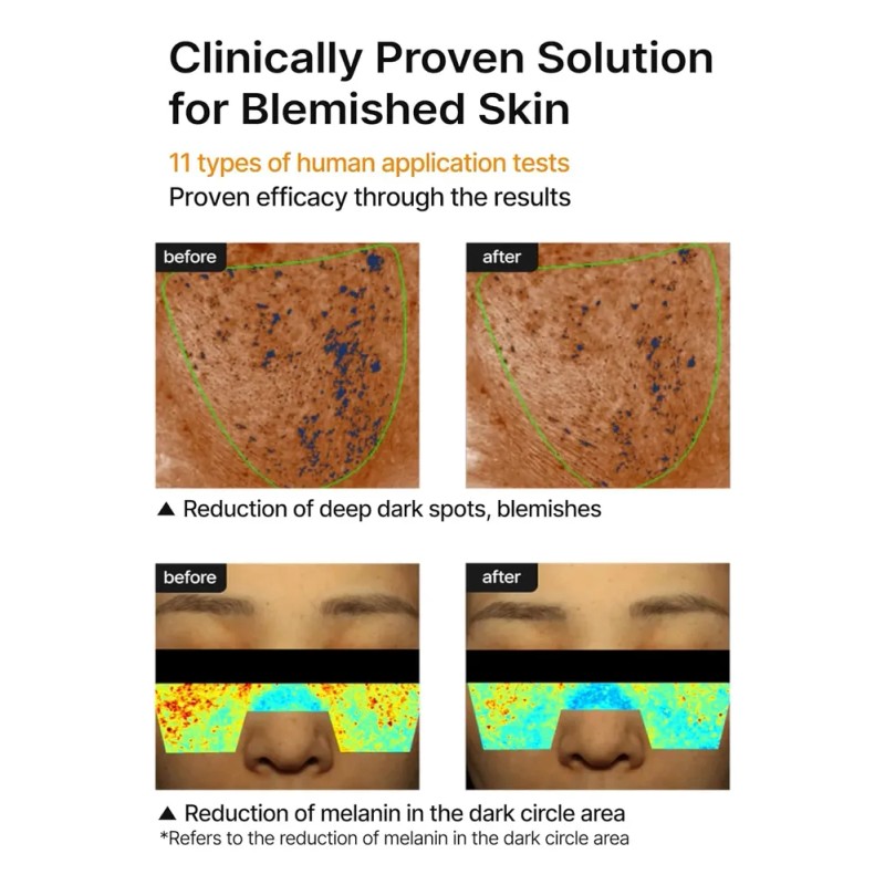 2pc Crema Celimax Pore+dark Spot 35ml Pieltodo Todo Dia