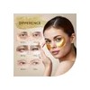 Parches Para Debajo De Los Ojos, Reparan Bolsas, Ojeras Y