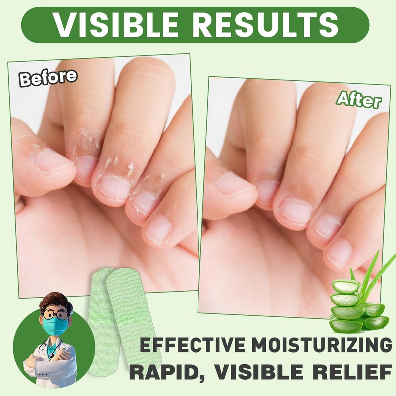50PCS Aloe Vera Cracked Hands Treatment Patches, Dry Cracked Hands