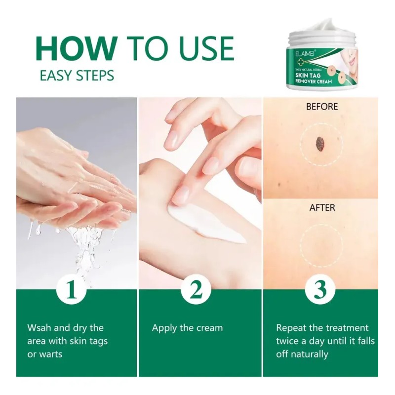 Crema Removedora Eficaz Mezquinos Verrugas Lunares Sin Dolor