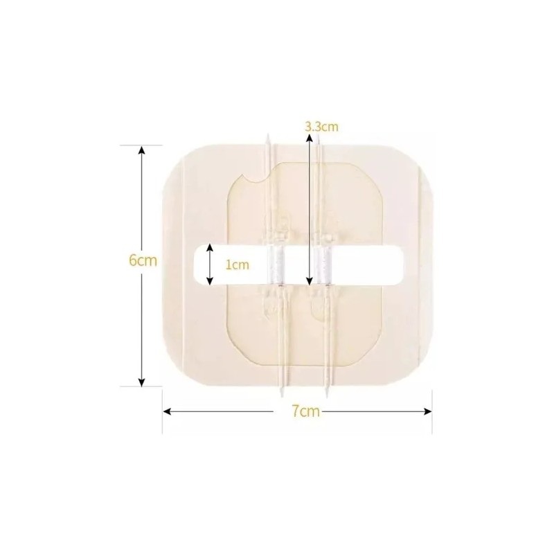 Tiras De Cierre Heridas De Emergencia,vendaje Puntada 4pcs