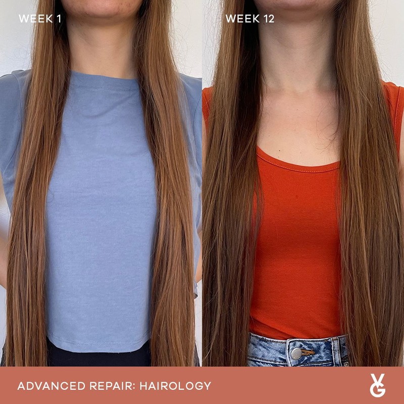 Vida Glow Hairology Advanced Repair - 30 Capsules