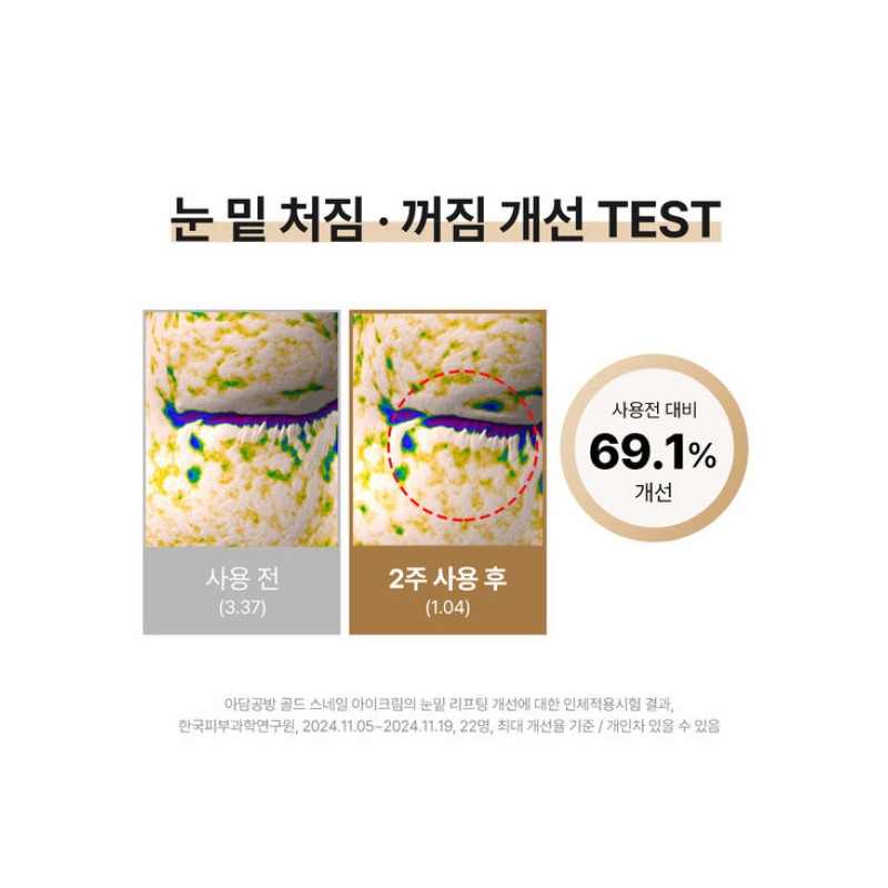 아담공방 GS 골드 스네일 눈가 눈밑 주름 개선 아이백 리프팅