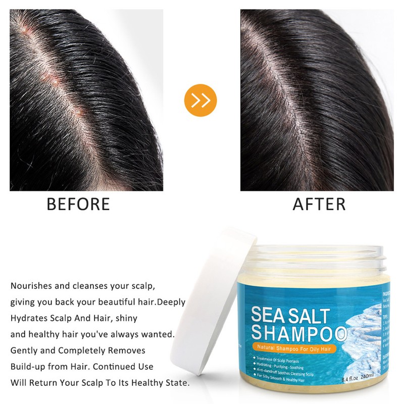 200ml Dandruff Shampoo Sea Salt Shampoo for Itching Scalp and