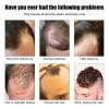Sérum Para Engrosar El Cabello Para Hombres Y Crecimiento De