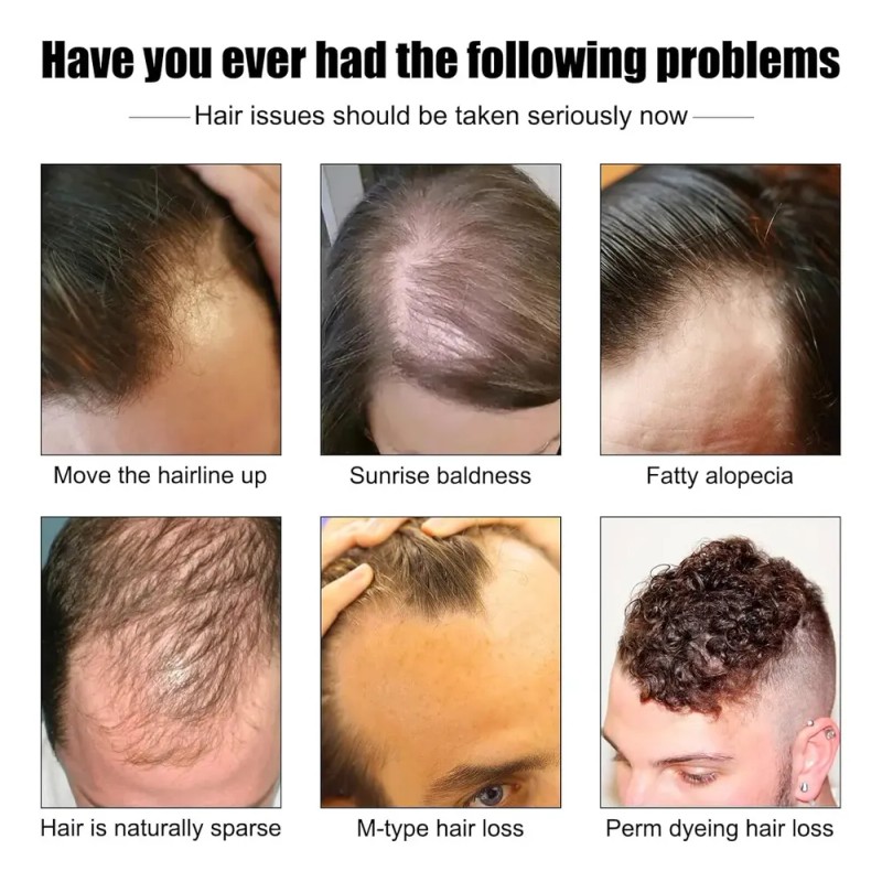 Sérum Para Engrosar El Cabello Para Hombres Y Crecimiento De